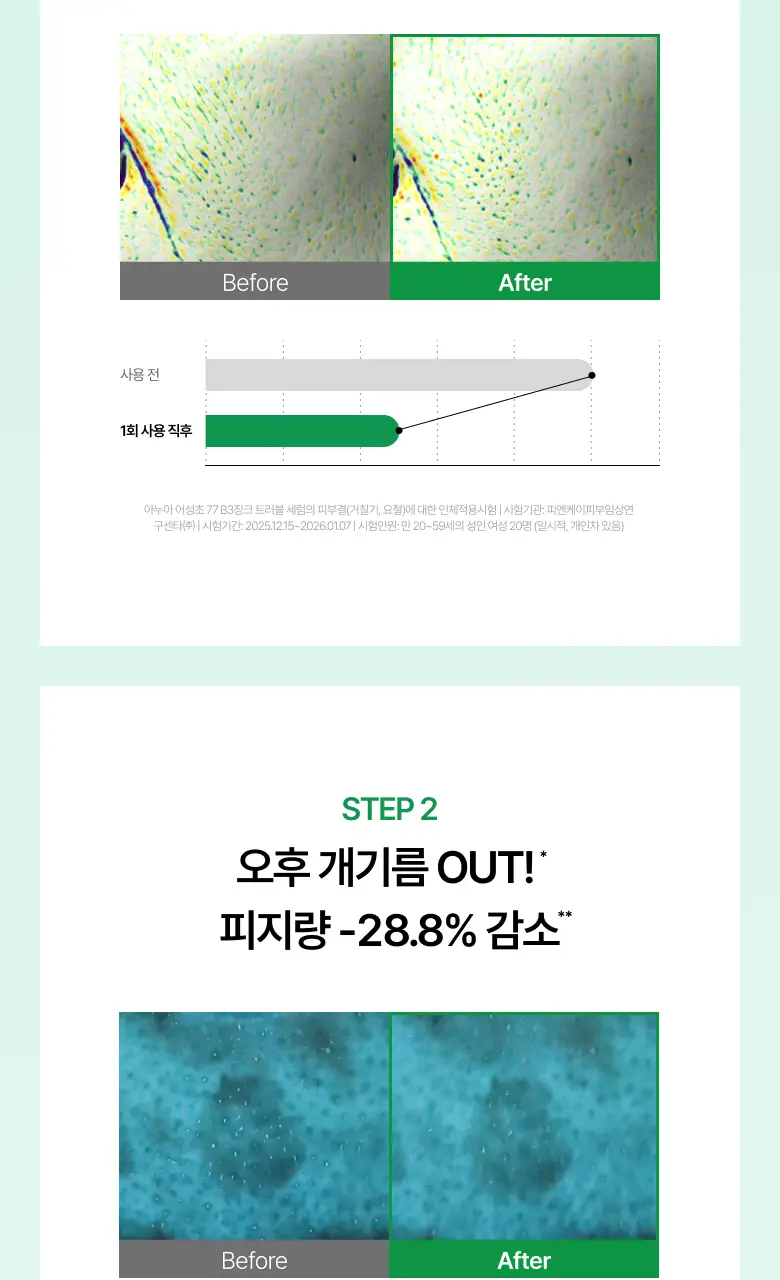 [NEW/리뉴얼] 아누아 어성초 77 B3 징크 트러블 세럼 30ml 상세페이지 19